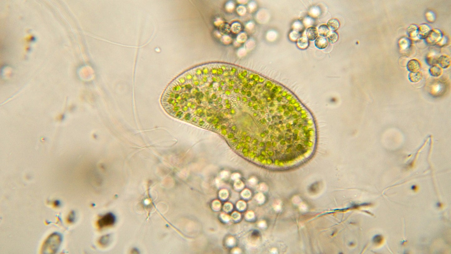 Paramecium bursaria under a microscope. All creatures whose cells house a nucleus, including Paramecium bursaria, can be traced back to a common ancestor called the Last Eukaryotic Common Ancestor (LECA).