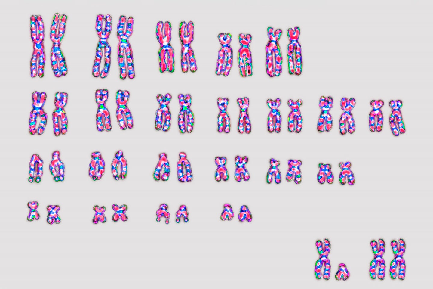 Karyotype of human chromosomes including sex chromosomes XY and XX