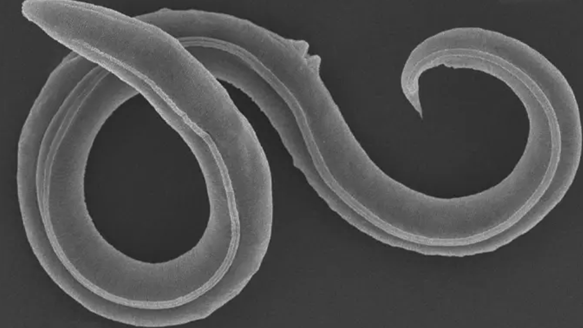 A scanning electron picture of a female Panagrolaimus kolymaensis nematode.
