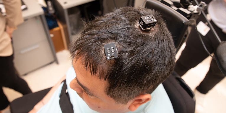 First-of-its-kind AI brain implant surgery helped a man regain feeling in his hand