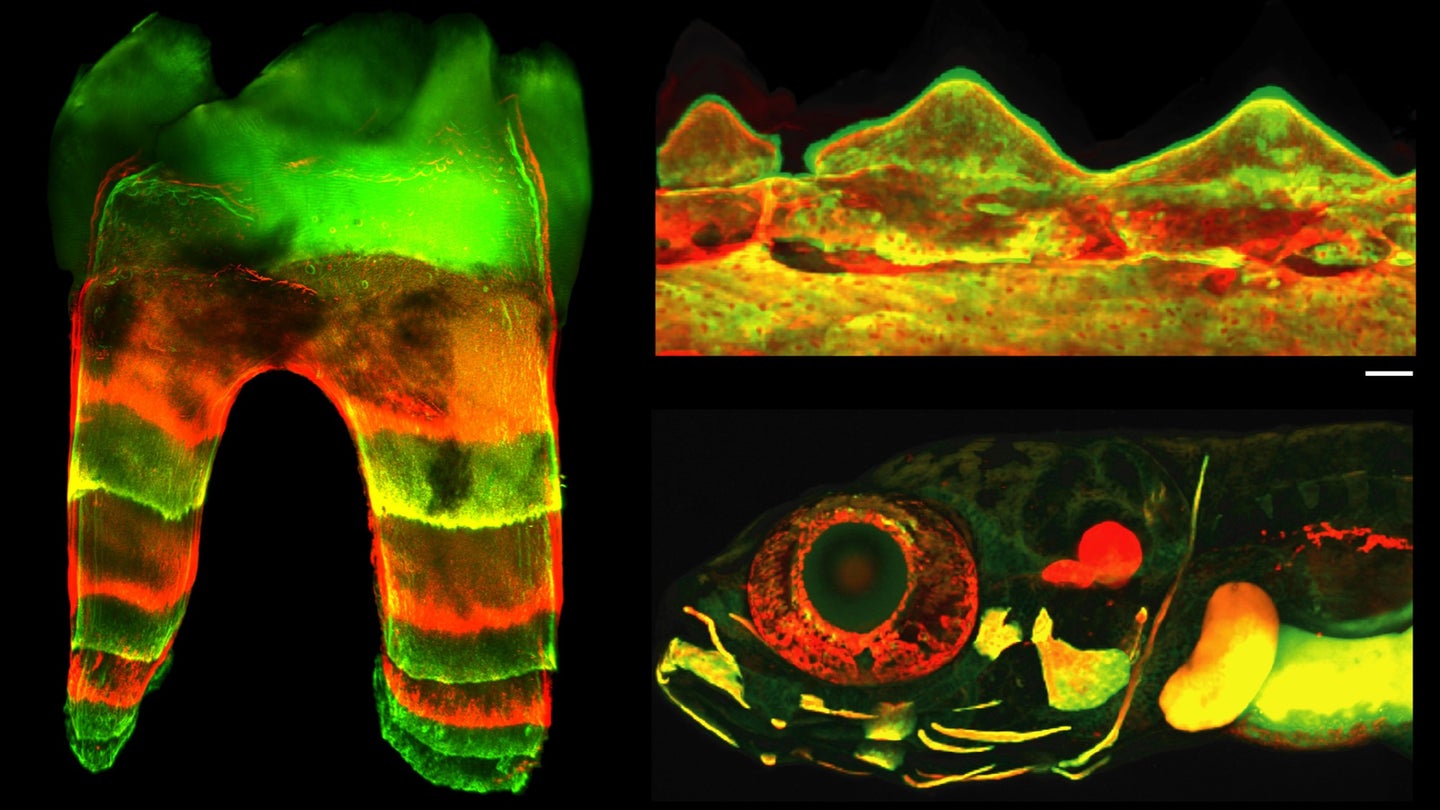 Fluorescent dye shows the growth of teeth and bones.