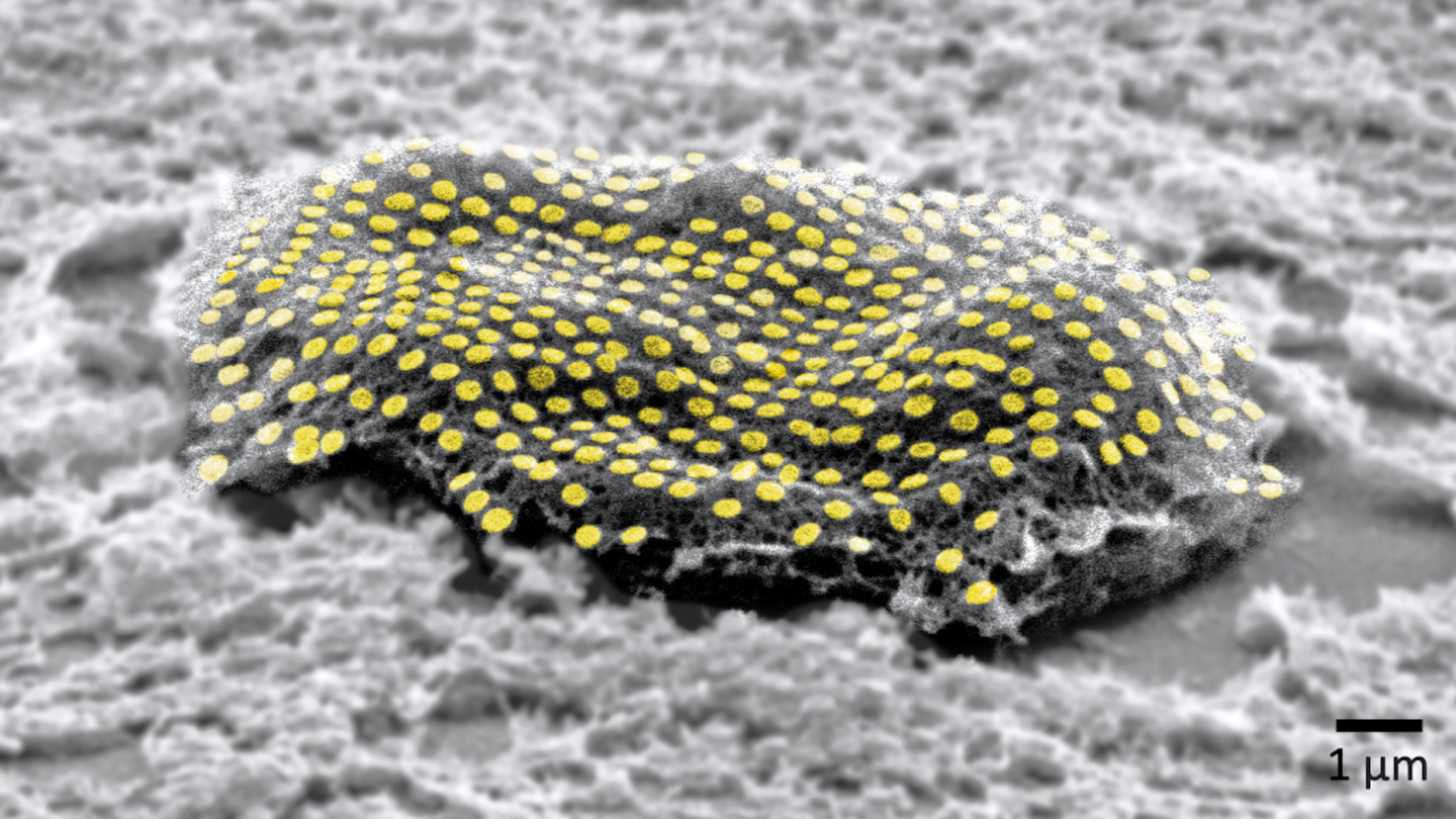 Microscopic image of individual cell tattooed with gold array