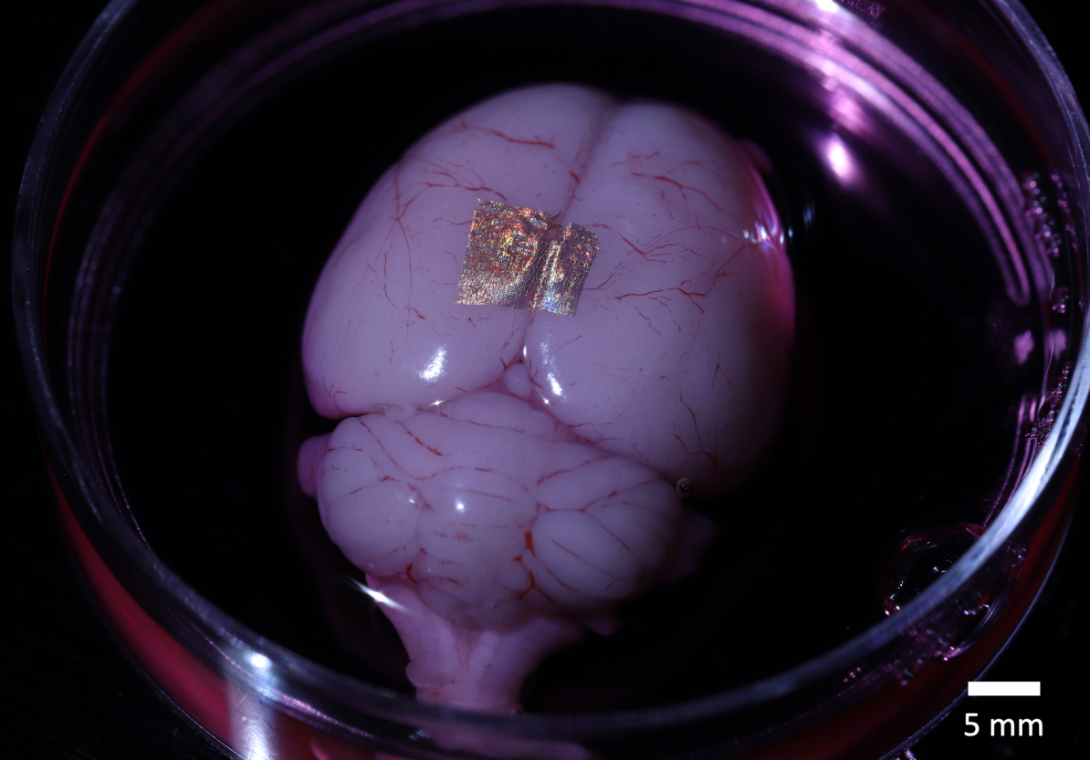 Gold nanowire array on a rat brain