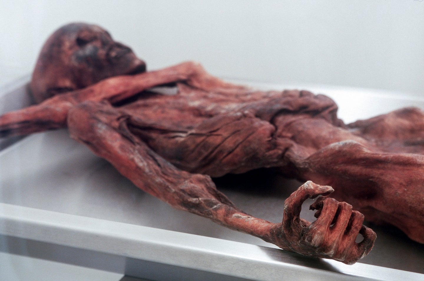 Otzi the Iceman remains laid out on a stretcher
