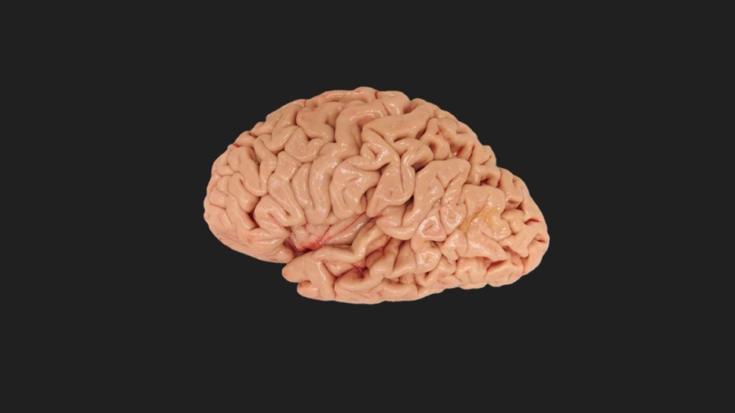 A pinkish human brain against a black background.