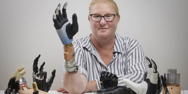 Titanium-fused bone tissue connects this bionic hand directly to a patient’s nerves