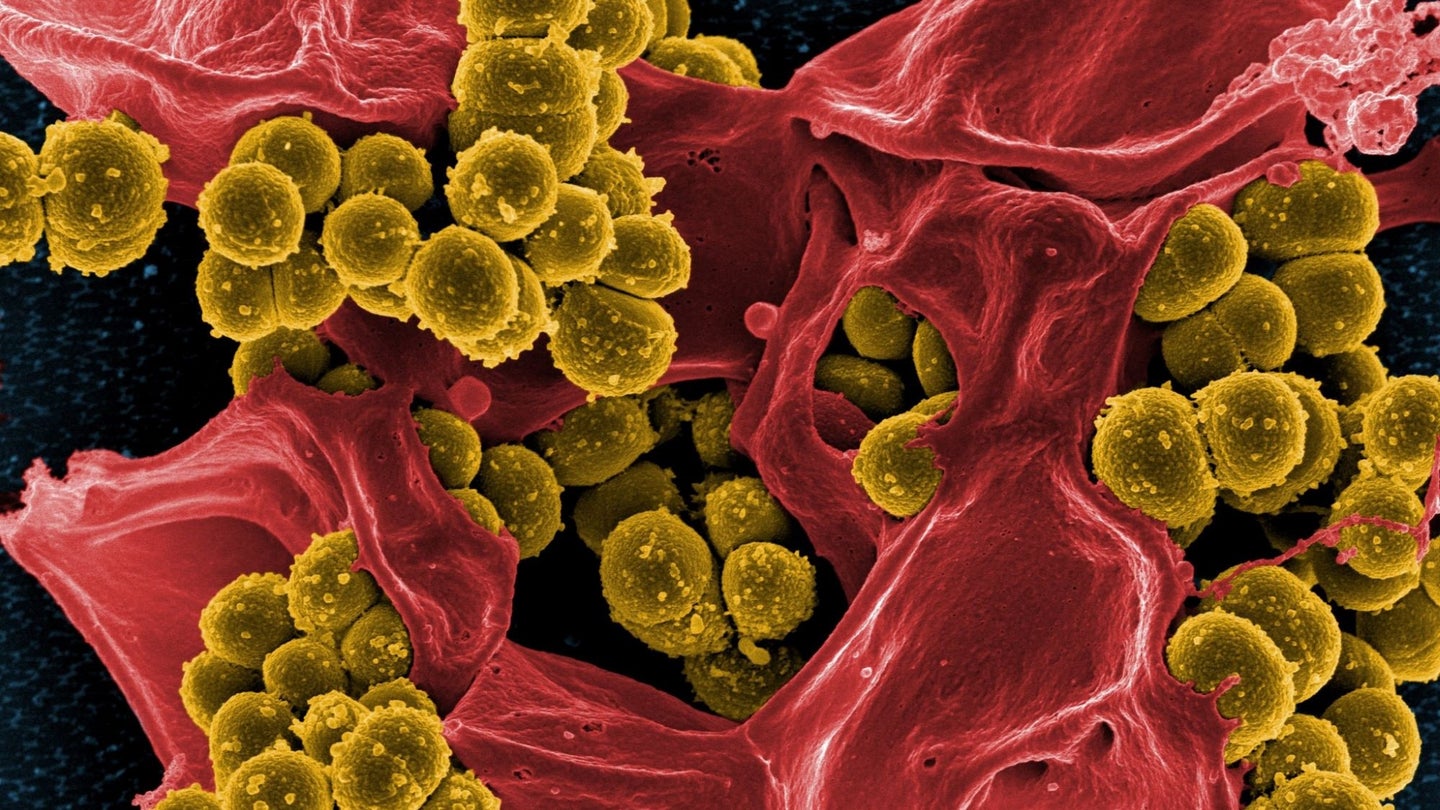 A microscopic image of small drug-resistant germs in yellow surrounding a larger human cell, in red.