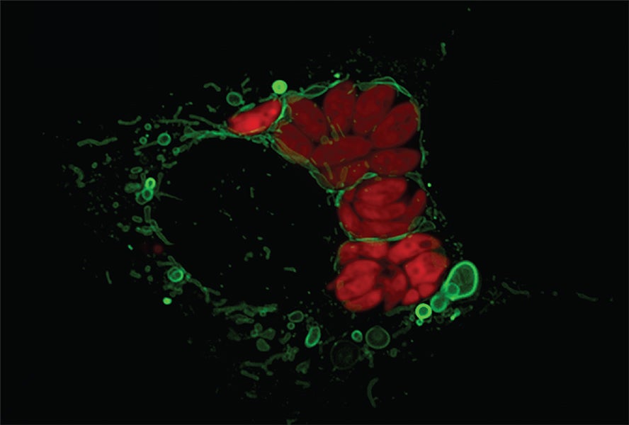 This microscopic image shows what happens when the parasite Toxoplasma gondii (in red) infects a mouse cell. The cell’s mitochondria (in green) gather around the invader and begin to shed vesicles (green bubbles) made of mitochondrial outer membrane. Sometimes, the vesicles can form elaborate, multilayered structures. Observations like this suggest a way in which the various endomembrane structures could have evolved early on during the evolution of eukaryotes. CREDIT: LENA PERNAS 