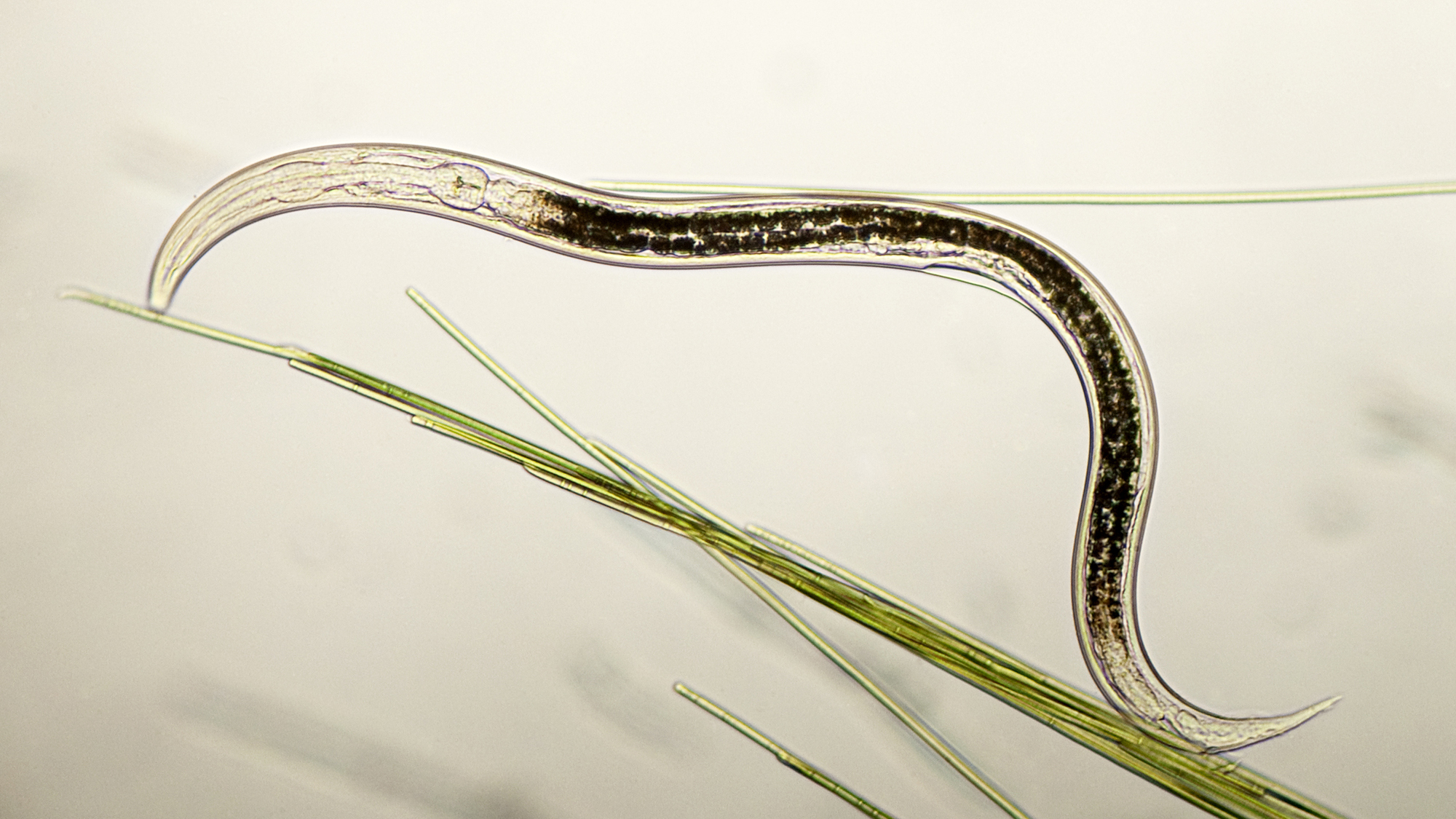 An aquatic nematode living in pond water among cyanobacteria. The small worms are sometimes trapped and eaten by carnivorous fungi.