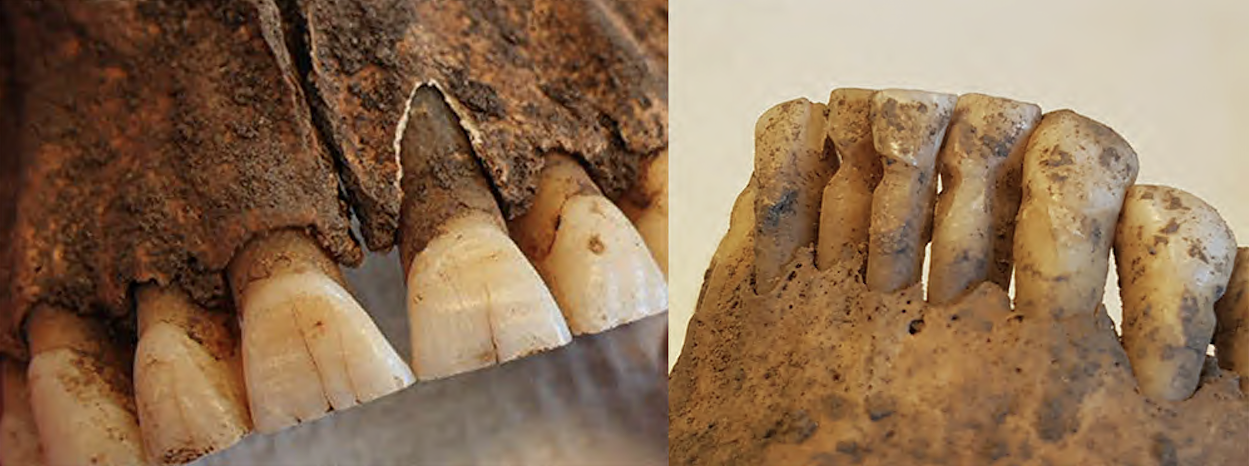 Viking teeth filed and picking