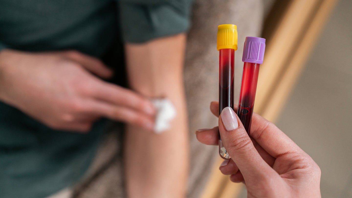 Blood tests provide clinicians with more information to guide diagnoses and treatment decisions.