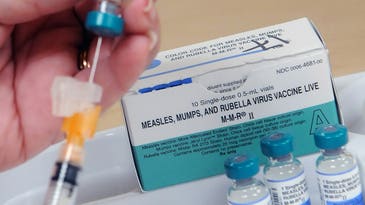 How to check your measles vaccination status amid outbreak