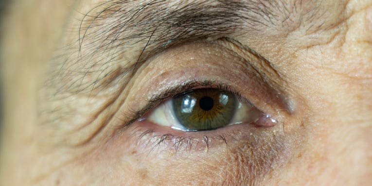 What you need to know about cataract surgery