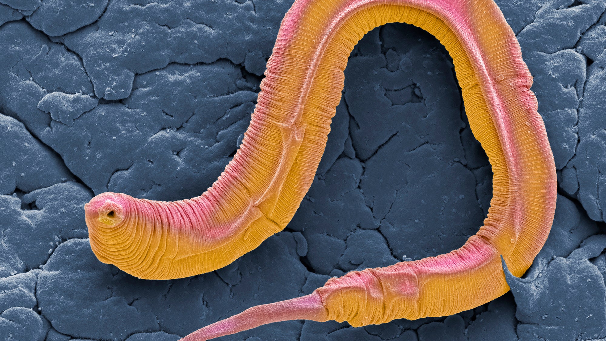 Por qué morimos: lecciones sobre genes de un humilde gusano