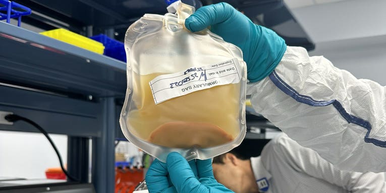 Experimental treatment grows livers from lymph nodes
