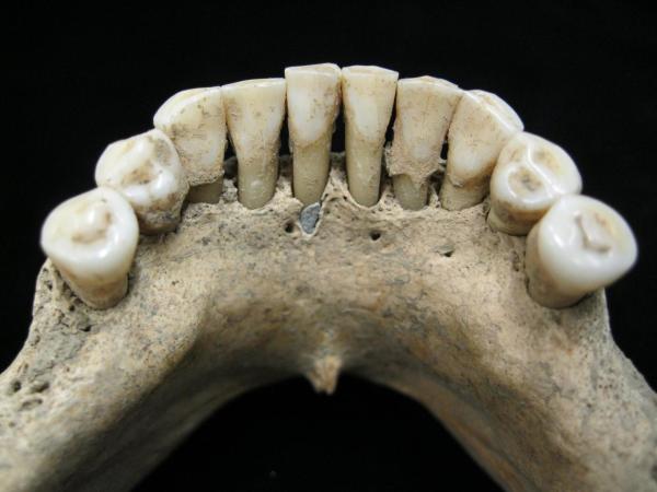 These 1,000-year-old, blue-specked teeth could rewrite medieval history