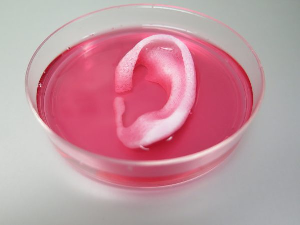 3D Bioprinter Creates Bone, Muscle–And Cartilage For This Ear