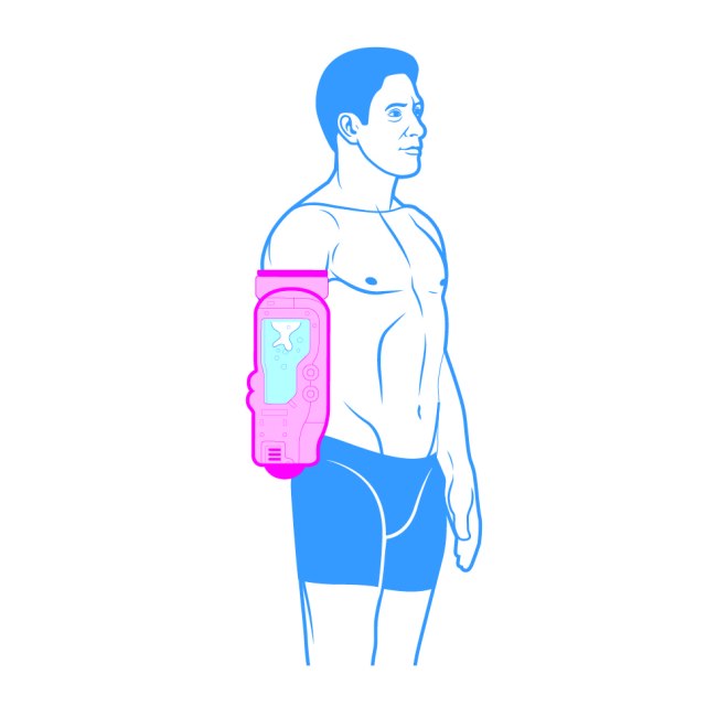 How to grow an arm