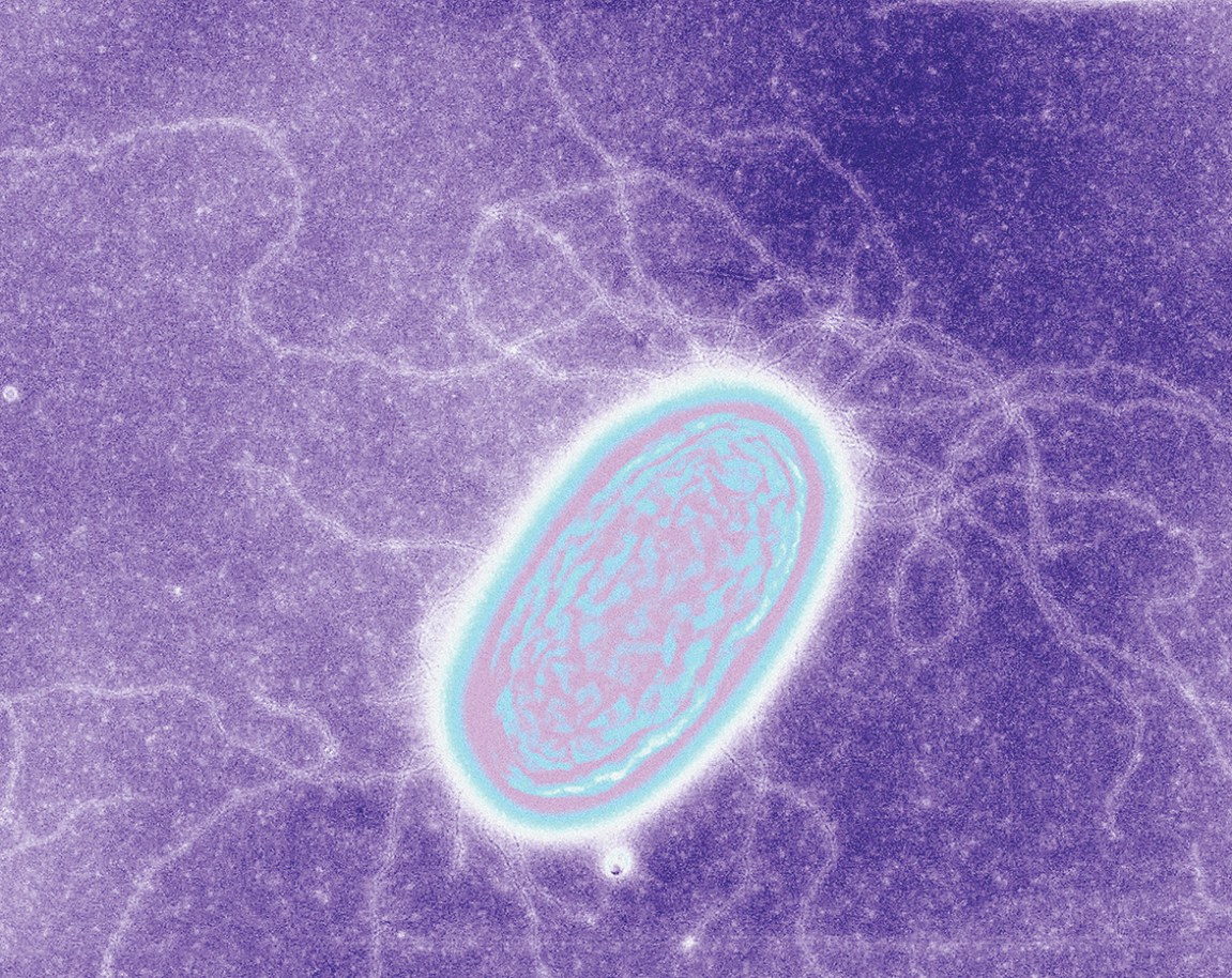 Have We Found Alien Life?