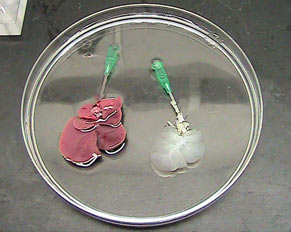 Researchers Successfully Rehab Used Livers into Healthy Organs, and Transplant Them