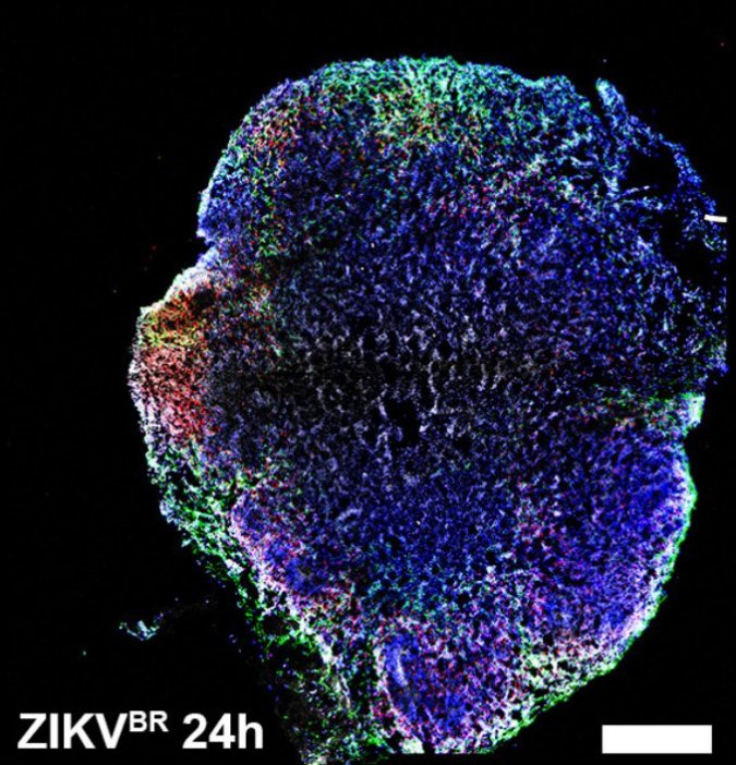 Zika Found To Cause Birth Defects In Newborn Mice