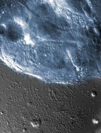 Specially Engineered Bacteria Could Replace Diabetics’ Insulin Shots With Insulin Yogurt Snacks