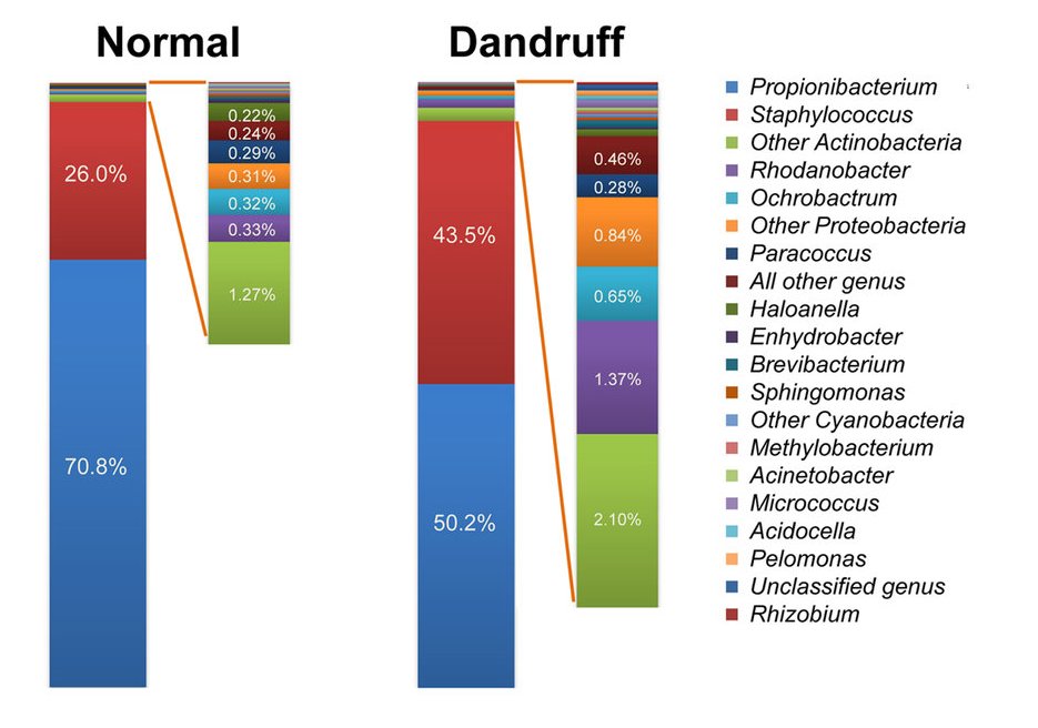 dandruff study chart