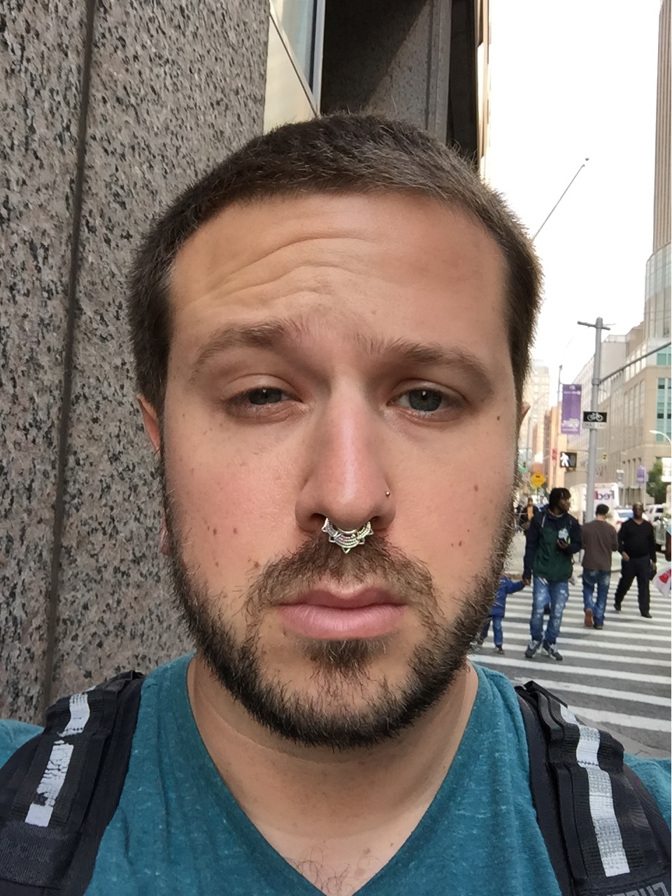 peter hess, a reporter with bell's palsy