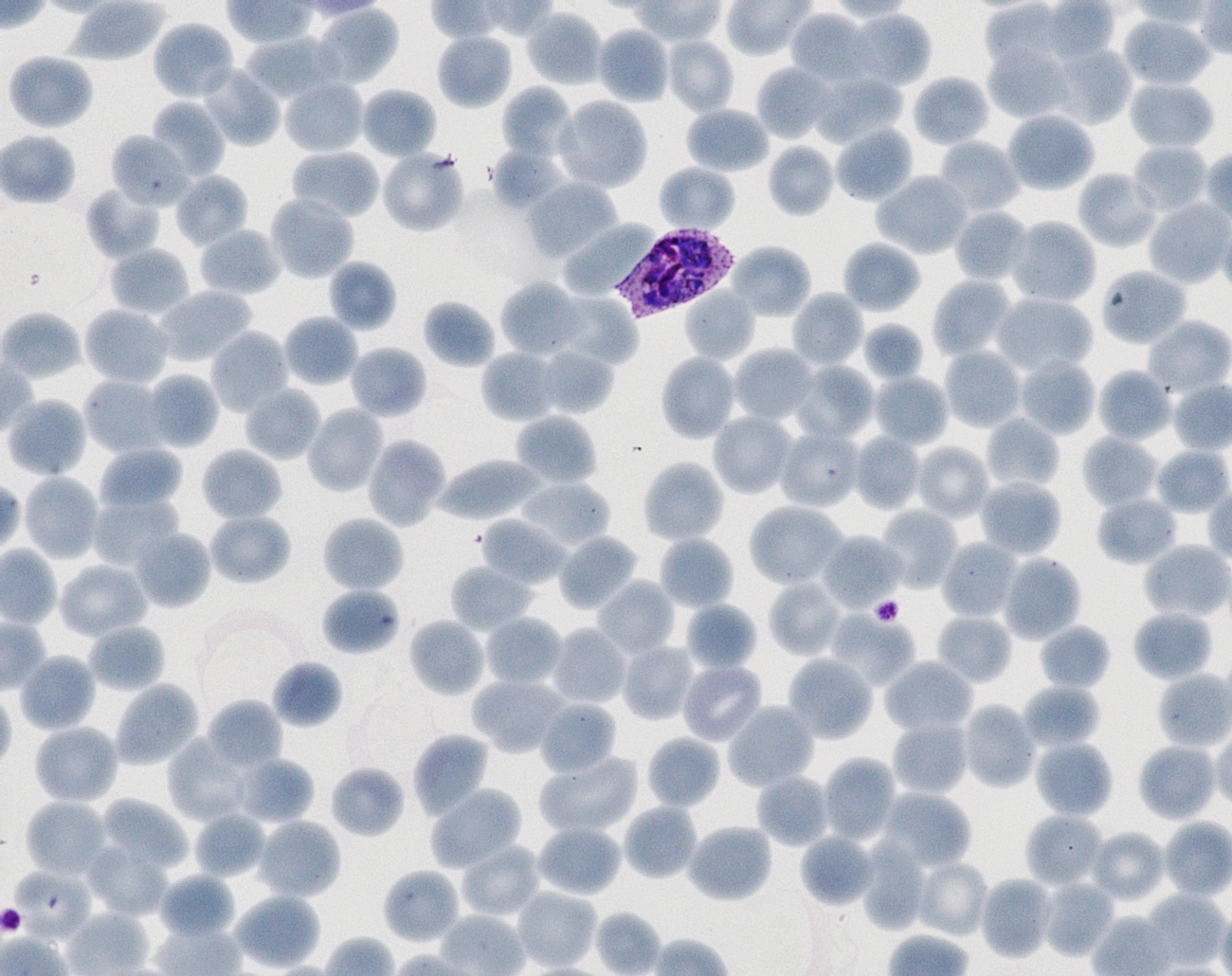 Malaria under the microscope
