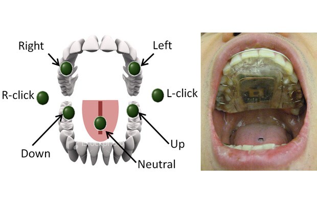 Steer Your Wheelchair With Your Computerized Tongue Piercing Steer Your Wheelchair With Your Computerized Tongue Piercing