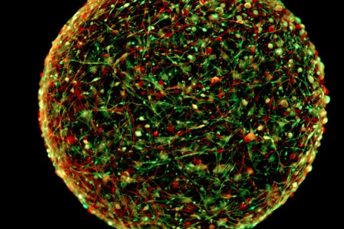 Mini-Brains Could Help Scientists Understand How Chemicals Affect The Brain