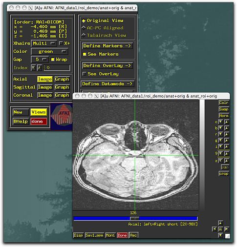 Mind-Reading Tech May Not Be Far Off