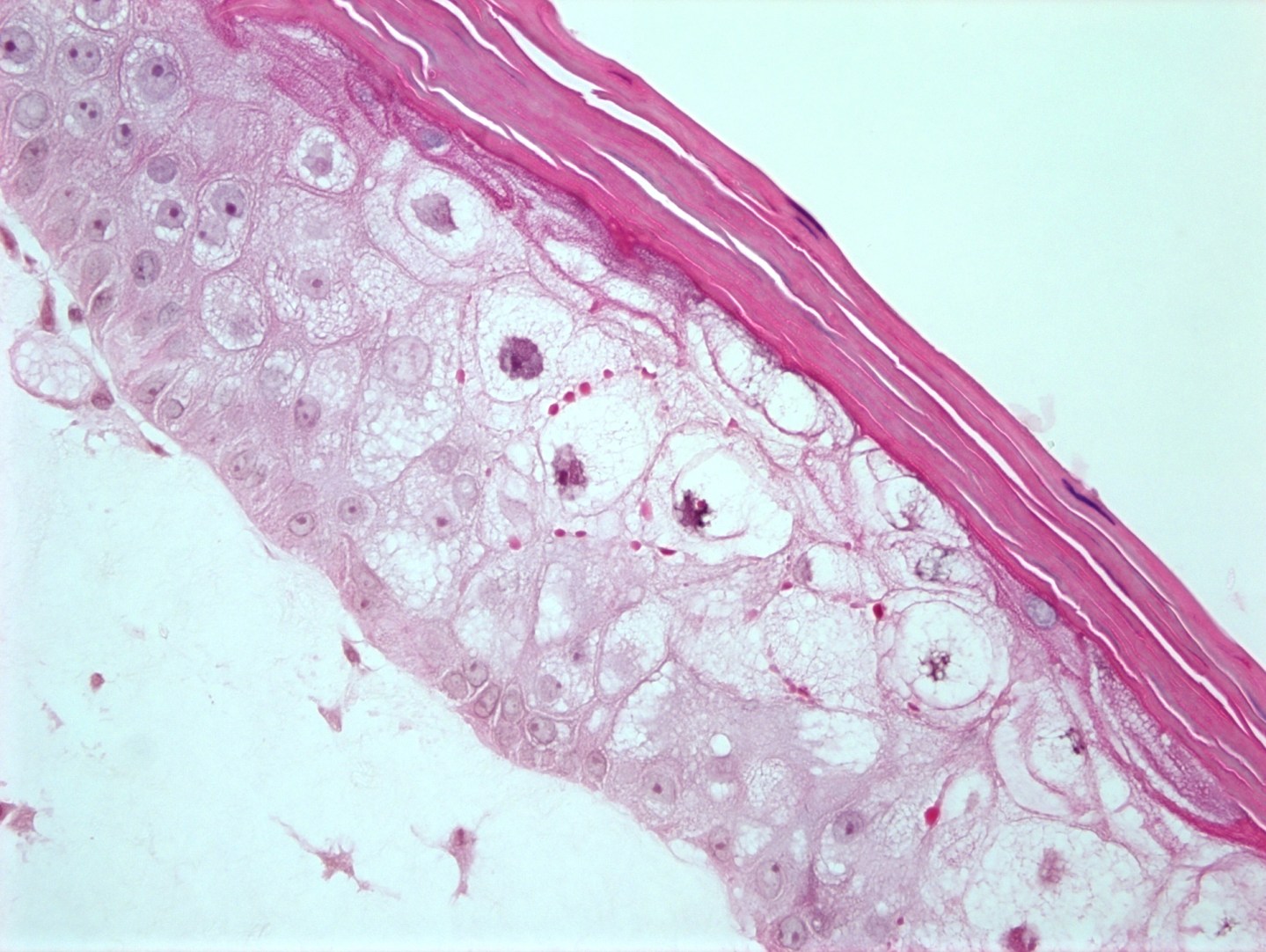 Turtle Skin Growing skin in a lab has benefits for humans and turtles alike