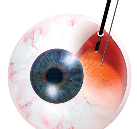 Frontiers of Medicine: Radical  Cures