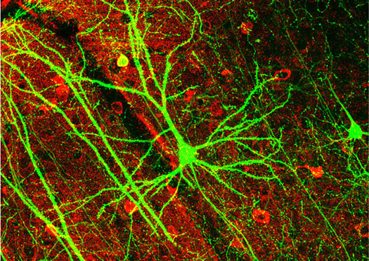 New Optogenetic Neural Implants Use Precise Beams of Light to Manipulate The Brain