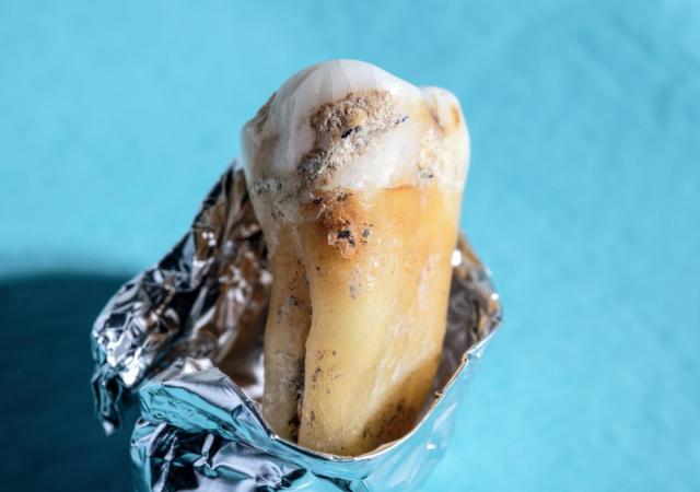 Ancient dental plaque shows humans have always loved carbs