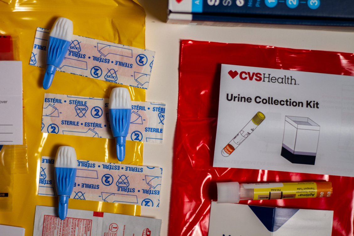 Are at-home STD tests reliable? | Popular Science
