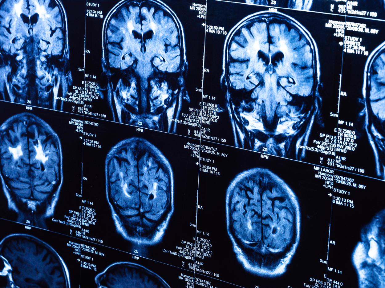 The pandemic may have sped aging in teen brains | Popular Science