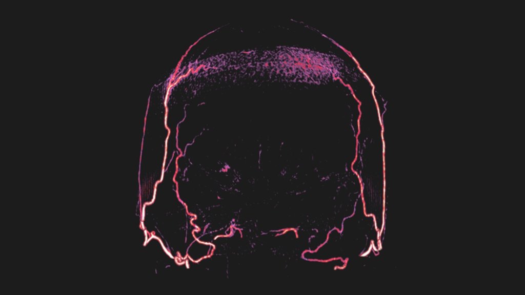 The allure and dangers of experimenting with brain-dead bodies ...