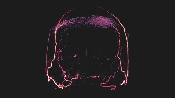 The allure and dangers of experimenting with brain-dead bodies ...