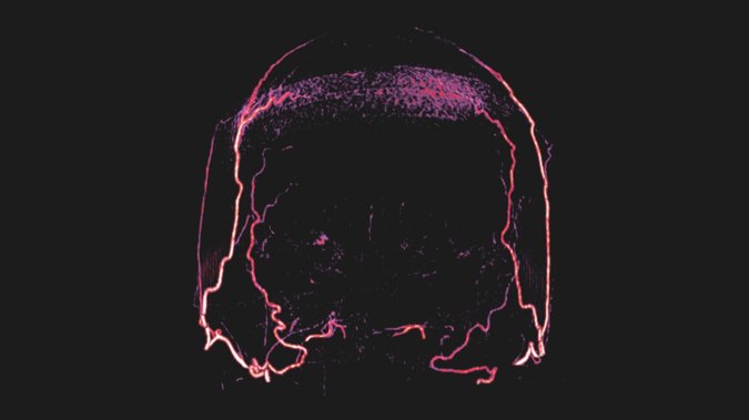 The allure and dangers of experimenting with brain-dead bodies ...