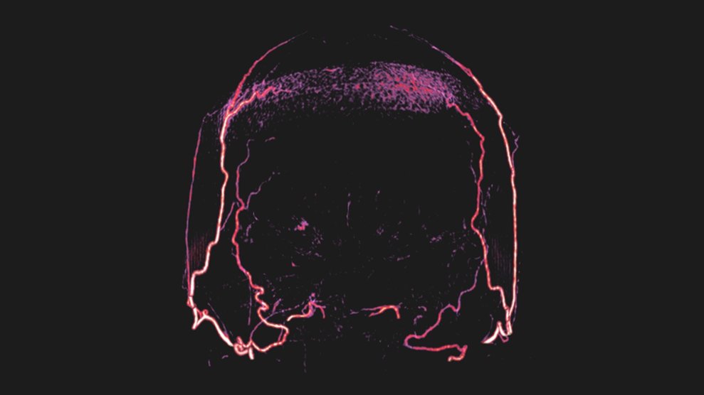 The allure and dangers of experimenting with brain-dead bodies ...