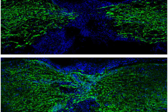 The top image shows fluorescently labeled cells in the spinal cord of a zebrafish recovering one week after an injury, and the bottom image shows recovery four weeks after an injury. CREDIT: Mokalled Lab. 