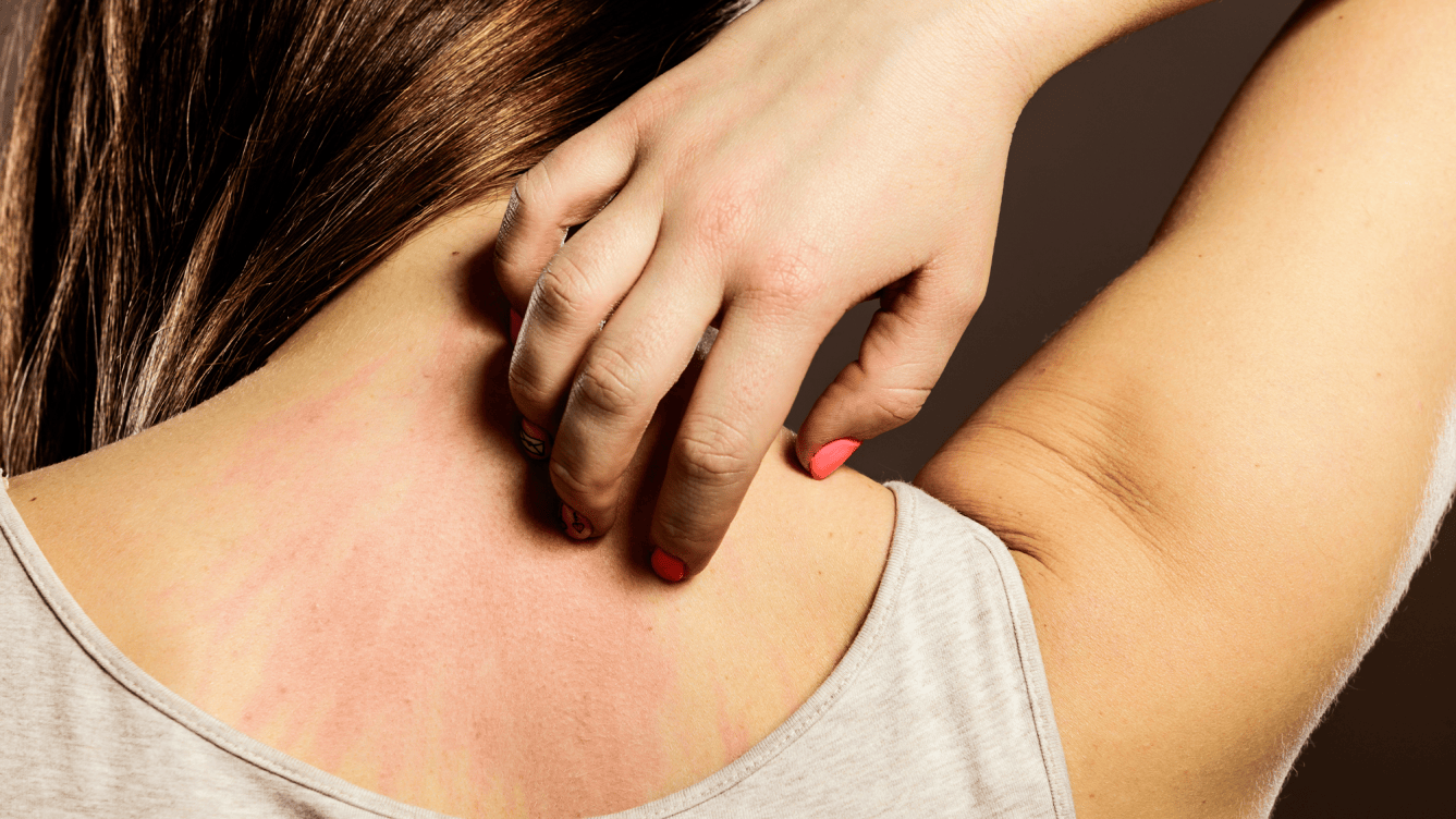 Scratching Reaction Why scratching a rash really does make it worse | Popular Science