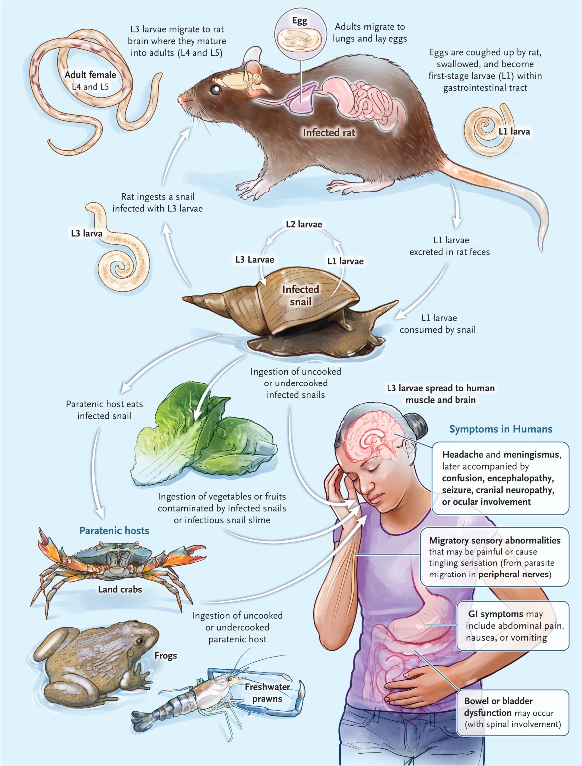 Brain Insect Parisite Animation Patient's tingling feet turns out to be a rat-borne brain parasite ...