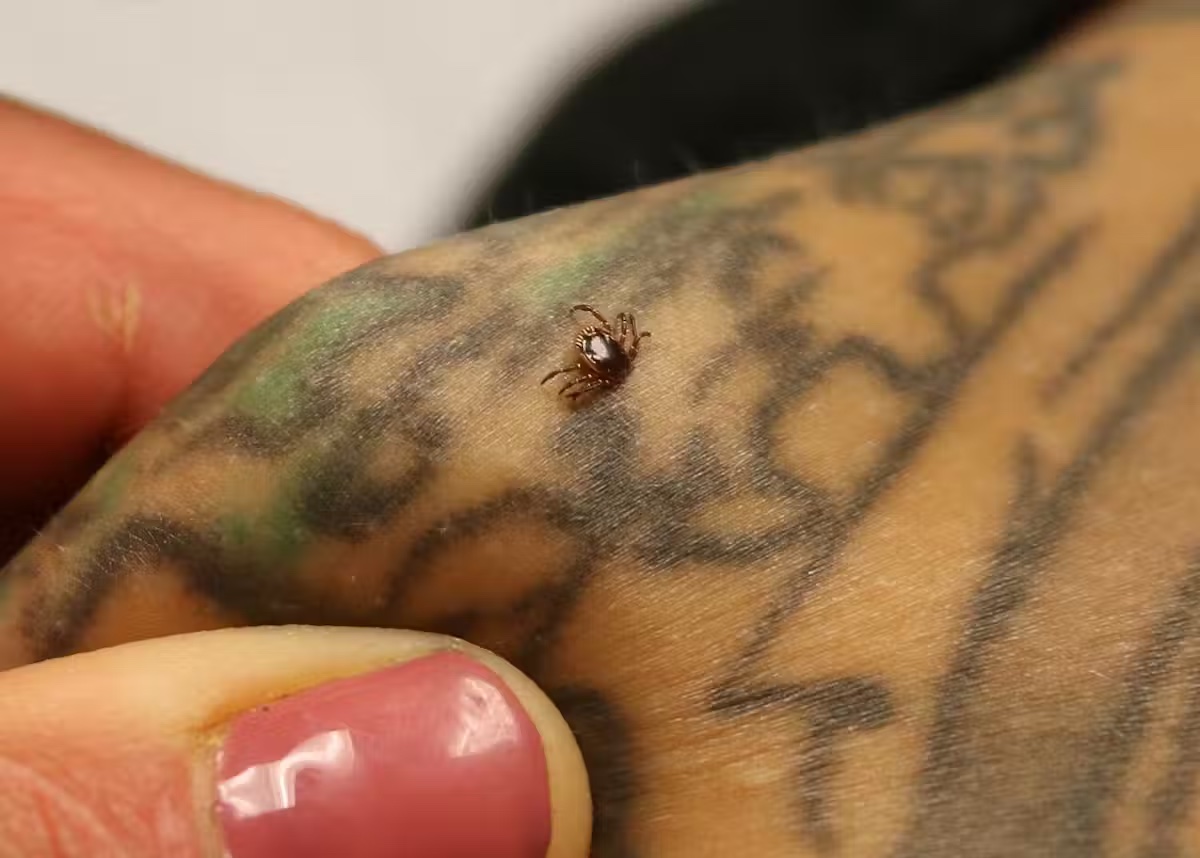a tick on someone's body