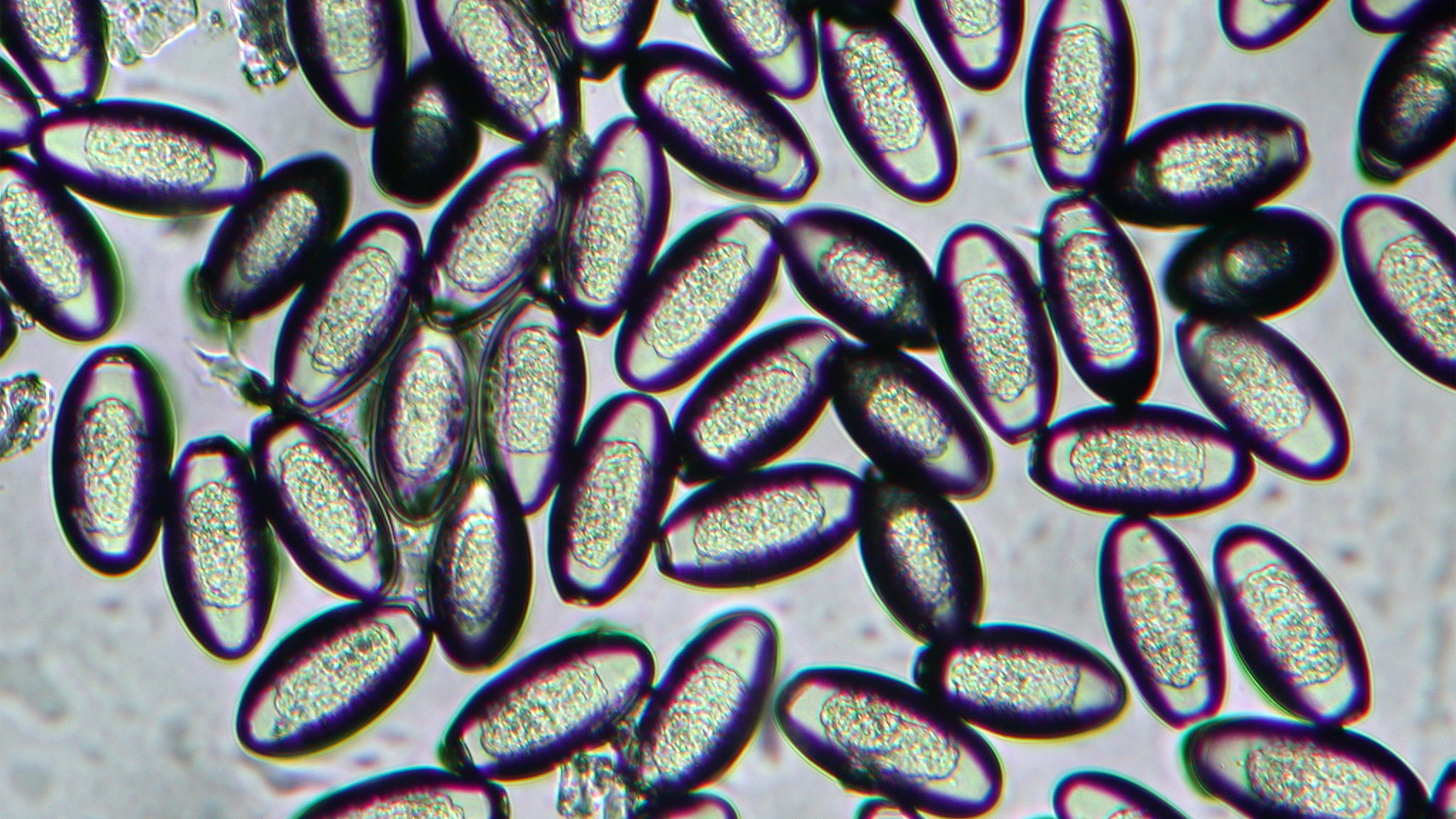 pinworm under microscope