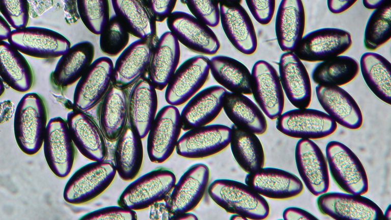 pinworm under microscope