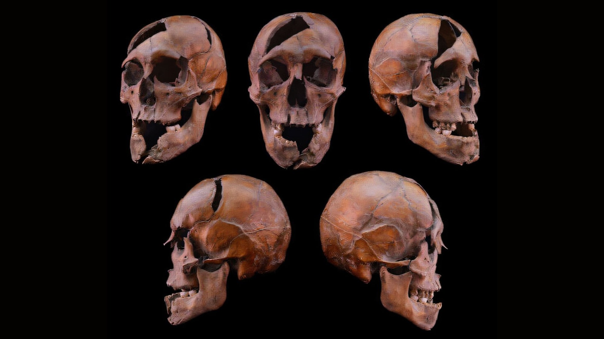 Various angles of fragmented human skull