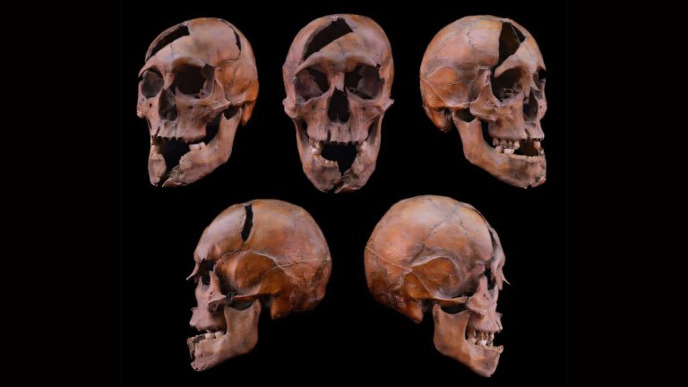 Various angles of fragmented human skull